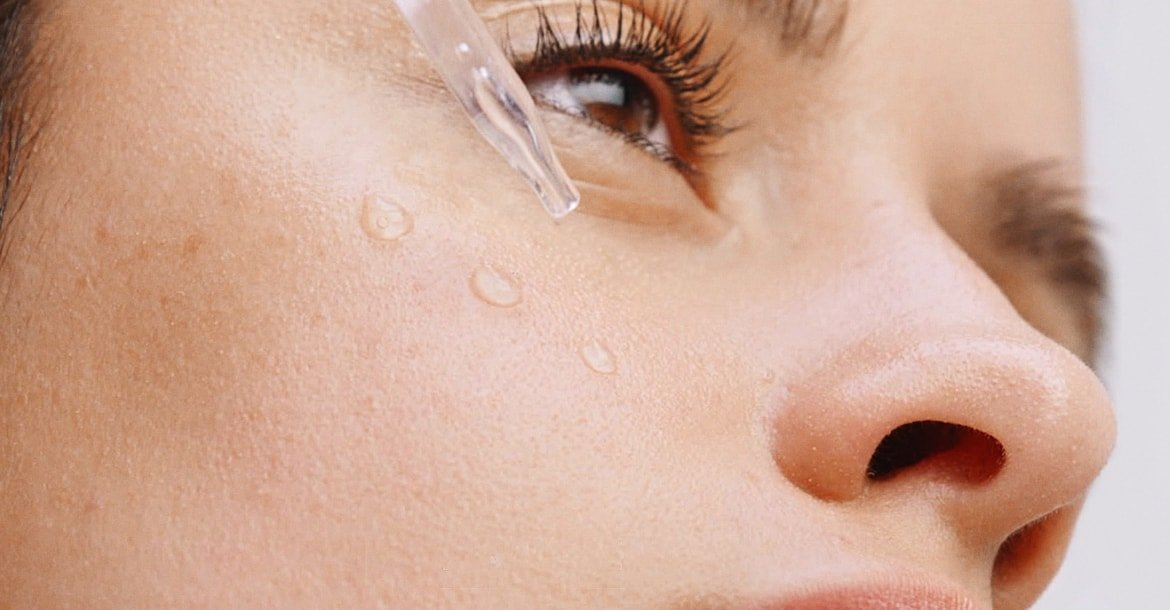 Redu Petele Pigmentare 01